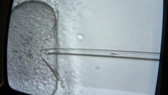 Photo prise sur un écran, d'un spermatozoïde s'apprêtant à pénétrer l'intérieur d'un ovocyte [AFP]
