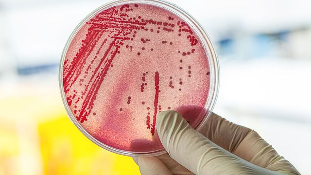 Les bactéries auraient différentes méthodes pour résister aux antibiotiques.
Photographee.eu
Fotolia [Photographee.eu - Fotolia]