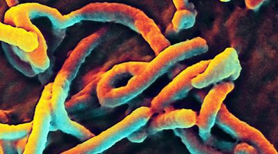 Le virus Ebola. [Keystone]