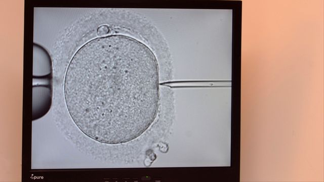 Une image d'un essai de procréation médicalement assistée avec la technique de l'ICSI. [Humbert - BSIP/AFP]