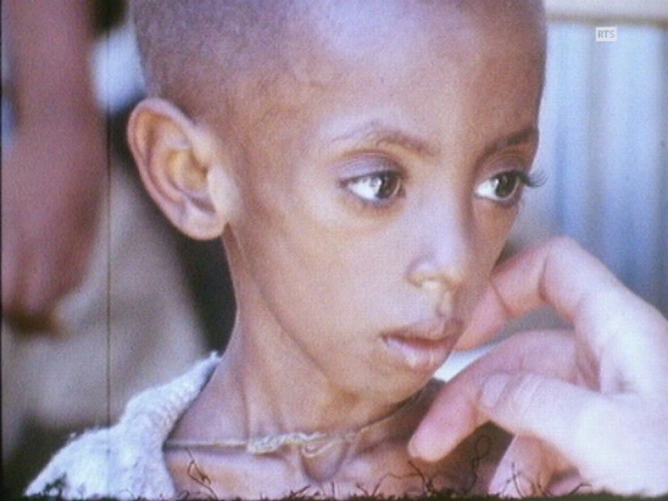 Enfant souffrant de malnutrition en Ethiopie en 1973. [RTS]