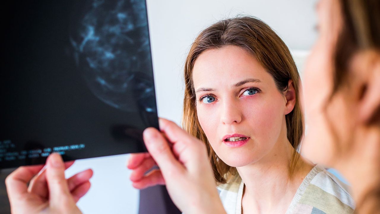 Est-il risqué d'effectuer des mammographies répétées? [Garo / Phanie - AFP]