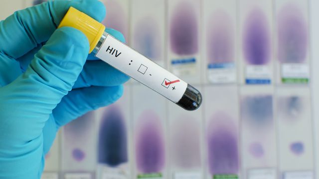 La Commission européenne autorise un nouveau traitement contre le virus du sida. [jarun011 - Fotolia]