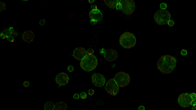 Des cellules immunitaires lymphocyte T cytotoxiques (petites) attaquant les cellules cancéreuses (grandes) à la suite du traitement contre Siglec-9 (en rouge). [Institut de pharmacologie de l'Université de Berne]
