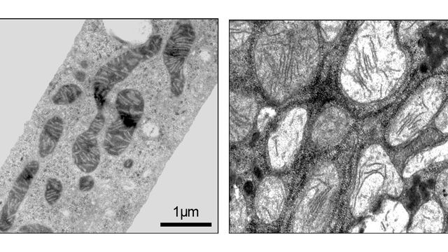 Mitochondries de cellules du foie en microscopie électronique. 
Pierre Maechler
Unige [Pierre Maechler - unige]