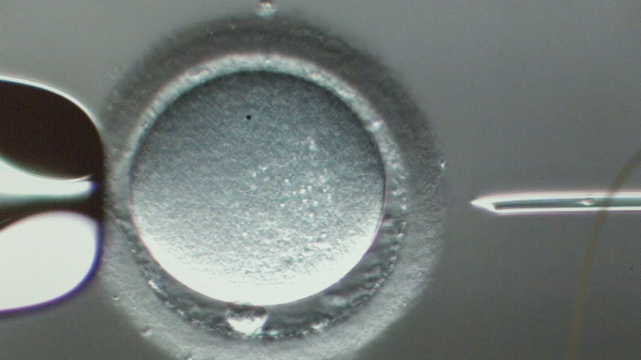 Injection d'un spermatozoïde dans un ovule [Gaetan Bally - keystone]
