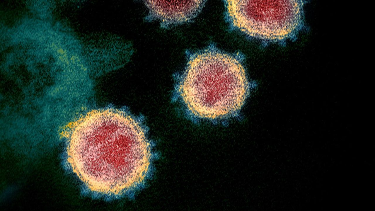 Cette image prise grâce à la Microscopie électronique en transmission montre le SARS-CoV-2, aussi connu sous les noms de coronavirus, Covid-19 et 2019-nCoV. Des particules du virus sont montrées en train d'émerger de la surface des cellules de culture, en laboratoire. Les pointes sur le bord extérieur de la particule sont les éléments qui donnent leur nom au coronavirus: corona, comme couronne. [NIAID-RML - CC]