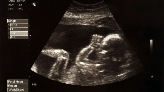 Au cours des neuf mois de grossesse, lʹutérus décuple de volume pour accueillir le fœtus. [mikdam - Depositphotos]