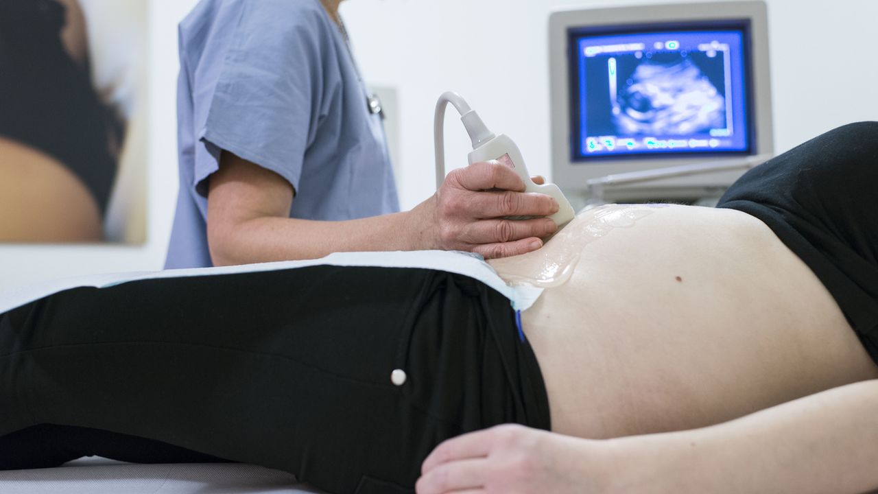 Une femme enceinte observe une échographie. [Christian Beutler - Keystone]