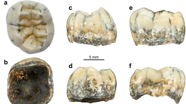 La molaire d'une fillette de Denisova du milieu du Pleistocène, trouvée dans le nord du Laos. Spécimen nommé TNH2-1.