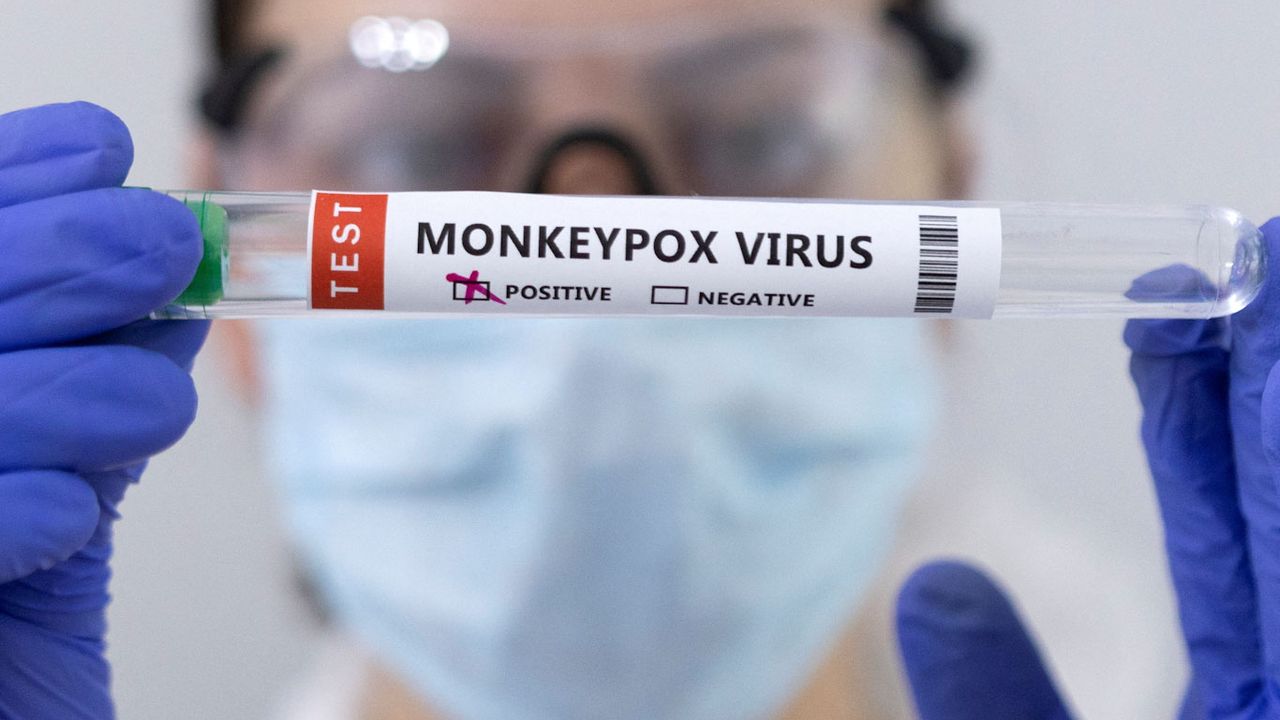 Une étude prône la vaccination préventive des personnes à risque contre la variole du singe [Dado Ruvic - Reuters]