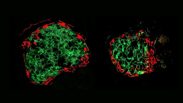 Lorsque le diabète commence à se développer, une partie des cellules bêta du pancréas (en vert) disparaissent (image de droite) en comparaison d’un individu sain (image de gauche). 
Laboratoire du Prof. Pierre Maechler
Unige [Laboratoire du Prof. Pierre Maechler - Unige]