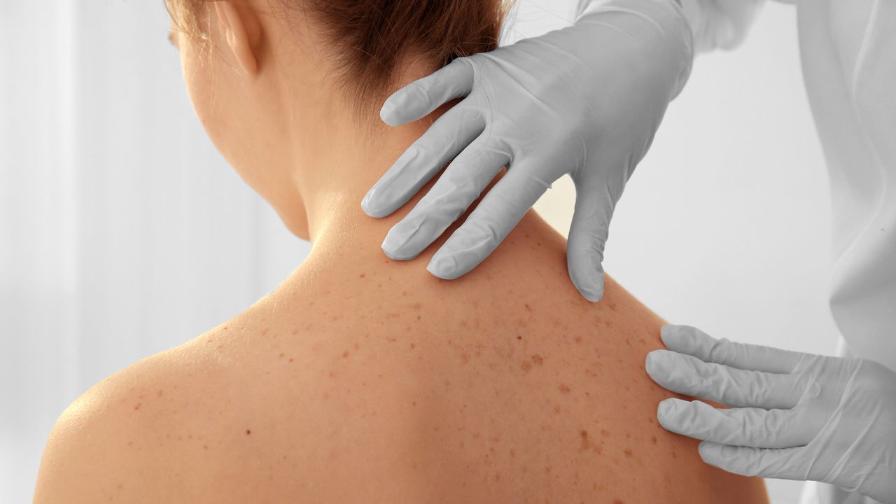 Une patiente se fait examiner par sa dermatologue. En Suisse, les cas de cancers de la peau ont doublé ces 30 dernières années. [Belchonock - Depositphotos]