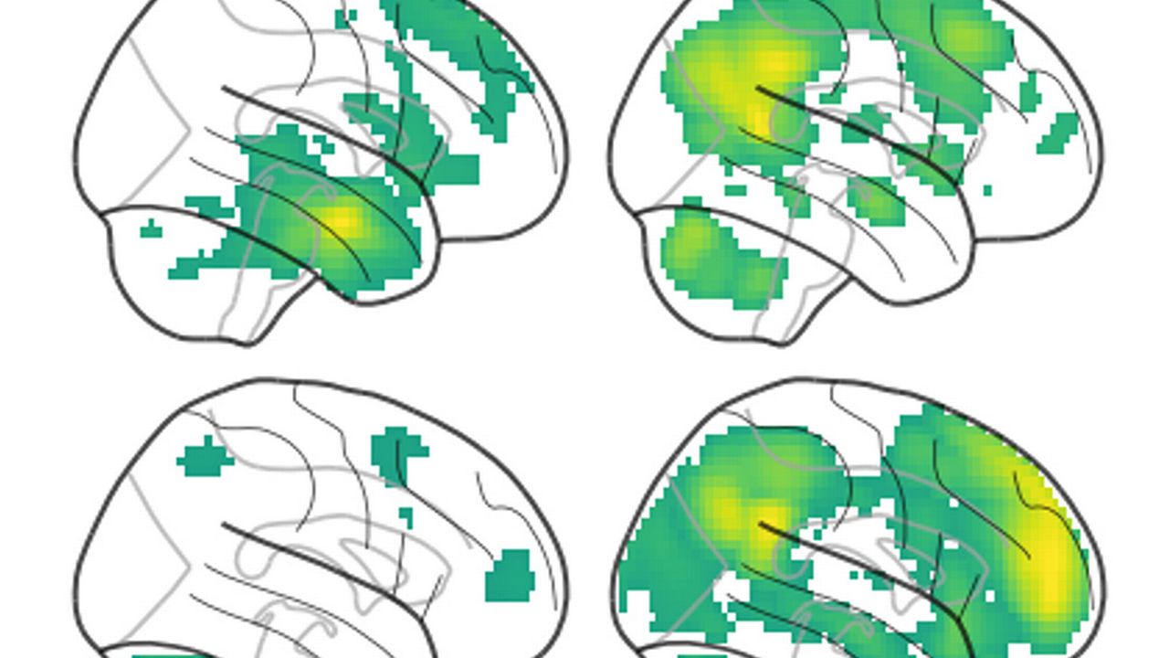 Une équipe de recherche de l'Université de Bâle a décrypté les signaux cérébraux nécessaires à une bonne mémoire. [Hirnaktivitäten, de Quervain/MCN - University of Basel/Nature Communications]